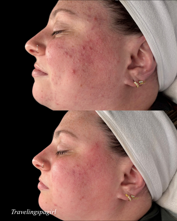 Before and after