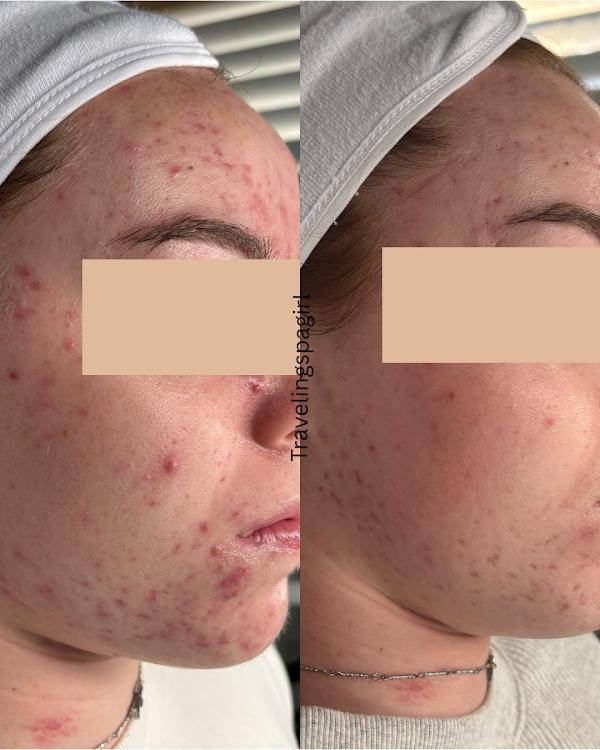 Before and after