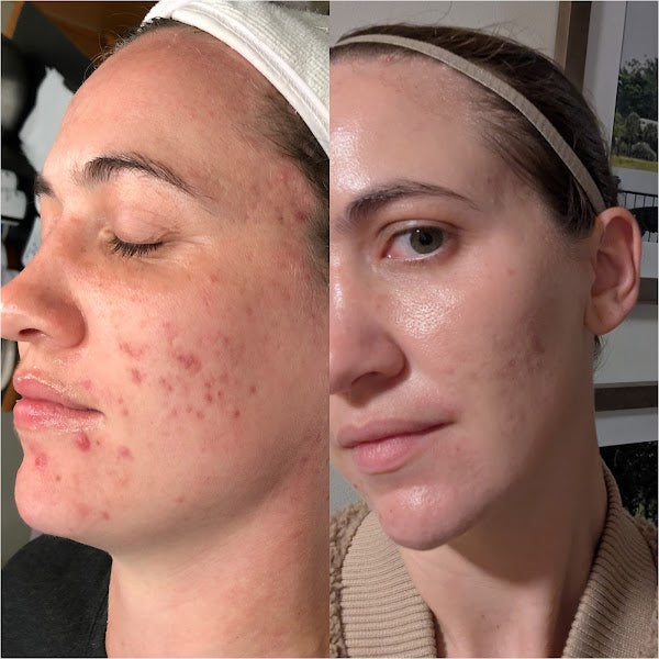 Before and after