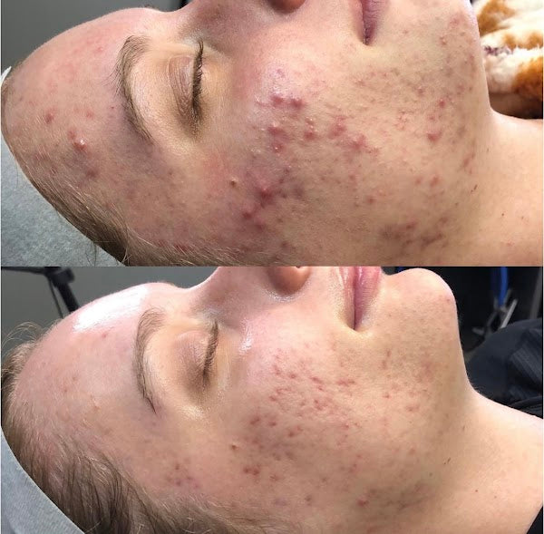 Before and after