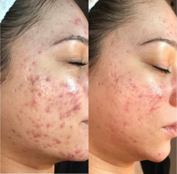 Before and after