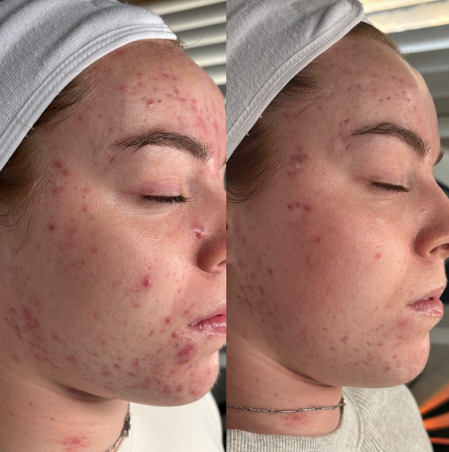 Before and after